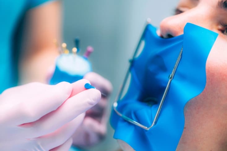 How Often Should You Visit the Dentist?