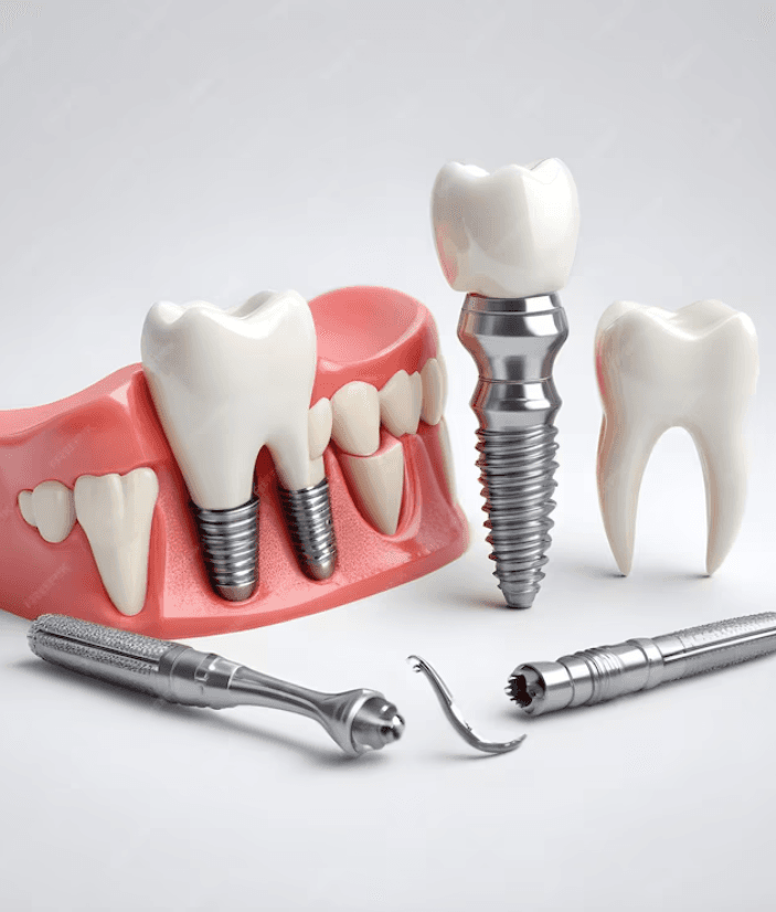 Dental Implants